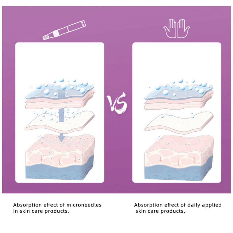 Professionele Derma Pen met Nano Naalden