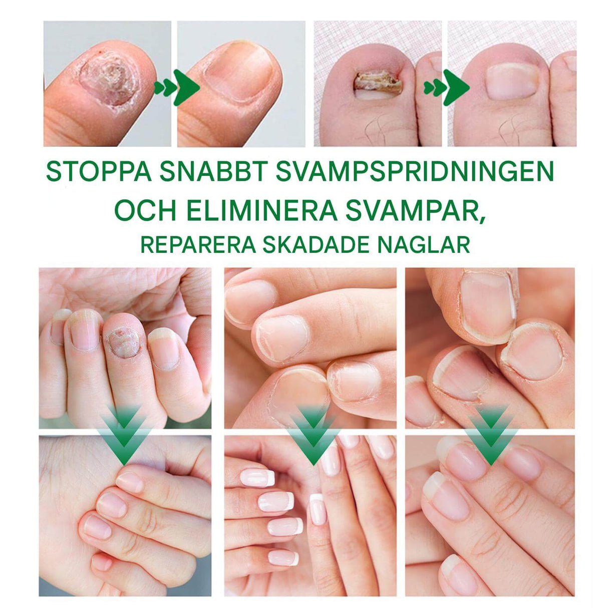 FungiClear - serum tegen schimmelnagels | Effectieve nagelverzorging voor sterkere nagels