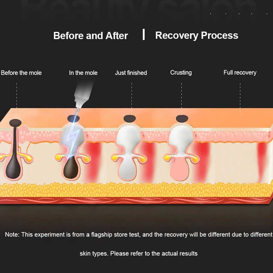Plasmapotlood huidtag verwijderen