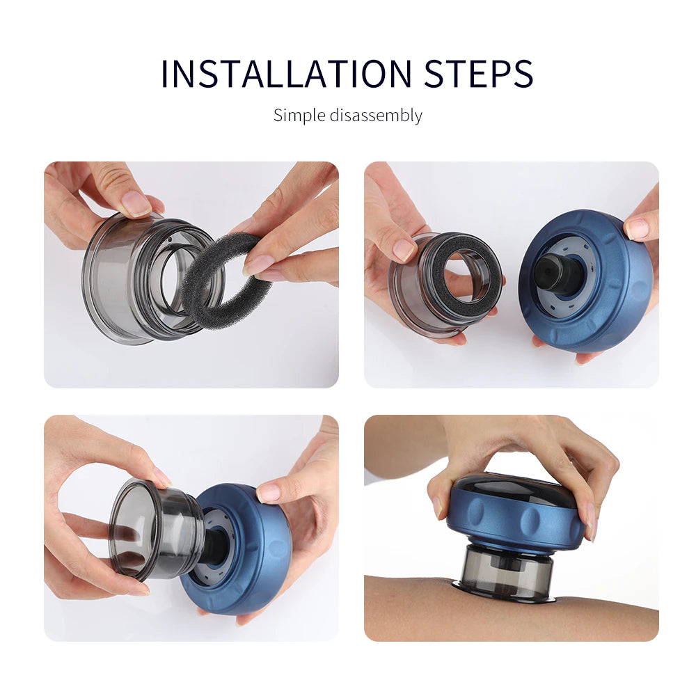 Cupping/Cupping Massage Vacuümbeker