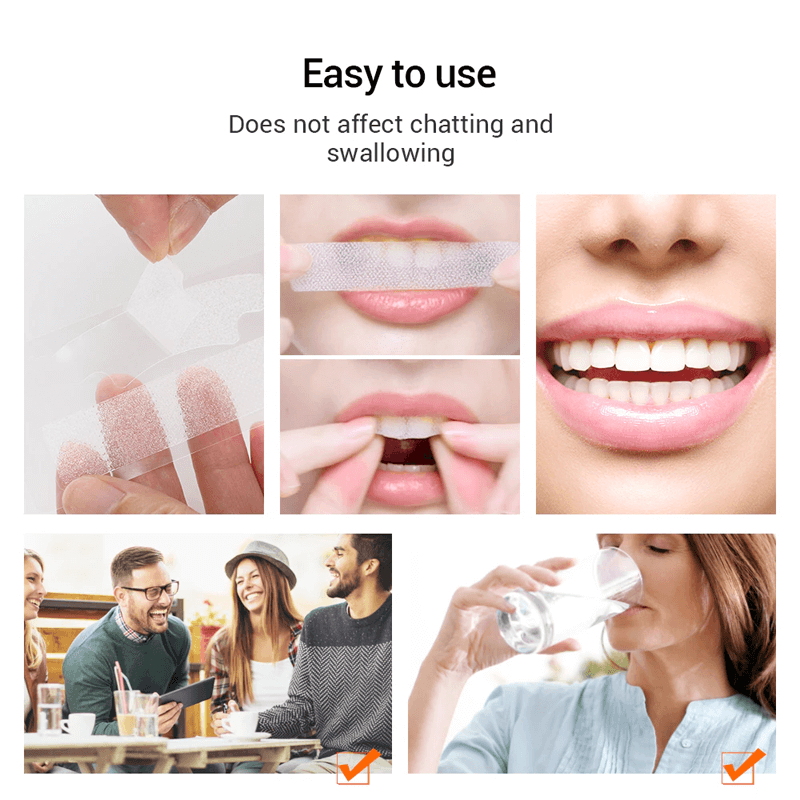 5D Gel Tanden Bleken Strips